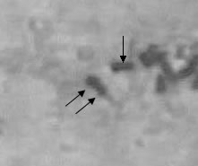 Chromosome 